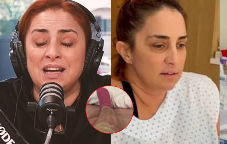 Quemada viva: la foto más impactante de María Julia Oliván tras someterse a 17 operaciones